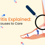 Arthritis, symptoms, its types, and more.