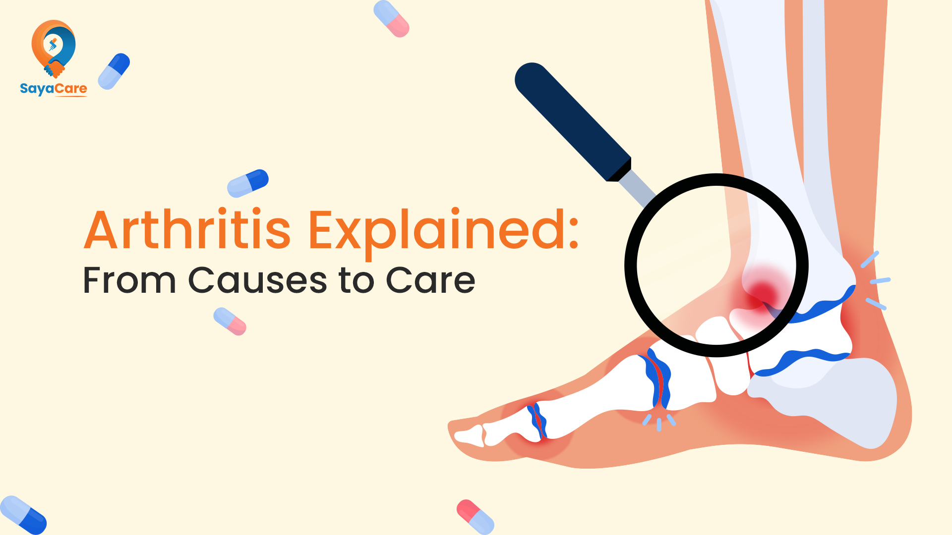 Understanding Arthritis: What You Should Know